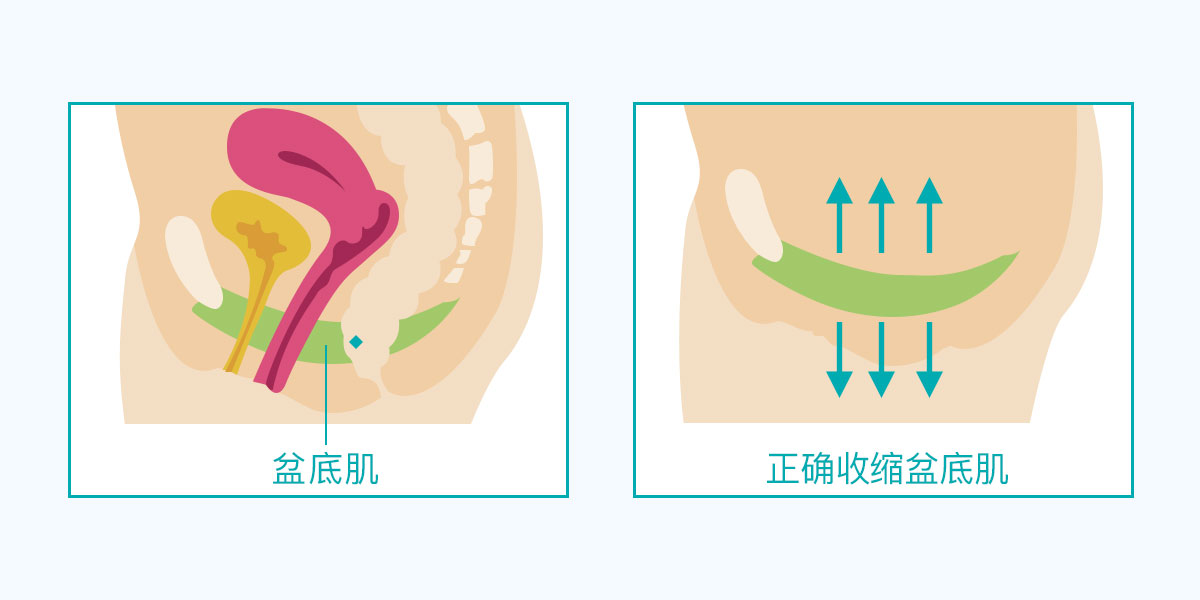 产后盆底肌修复的最佳时期是什么时候？