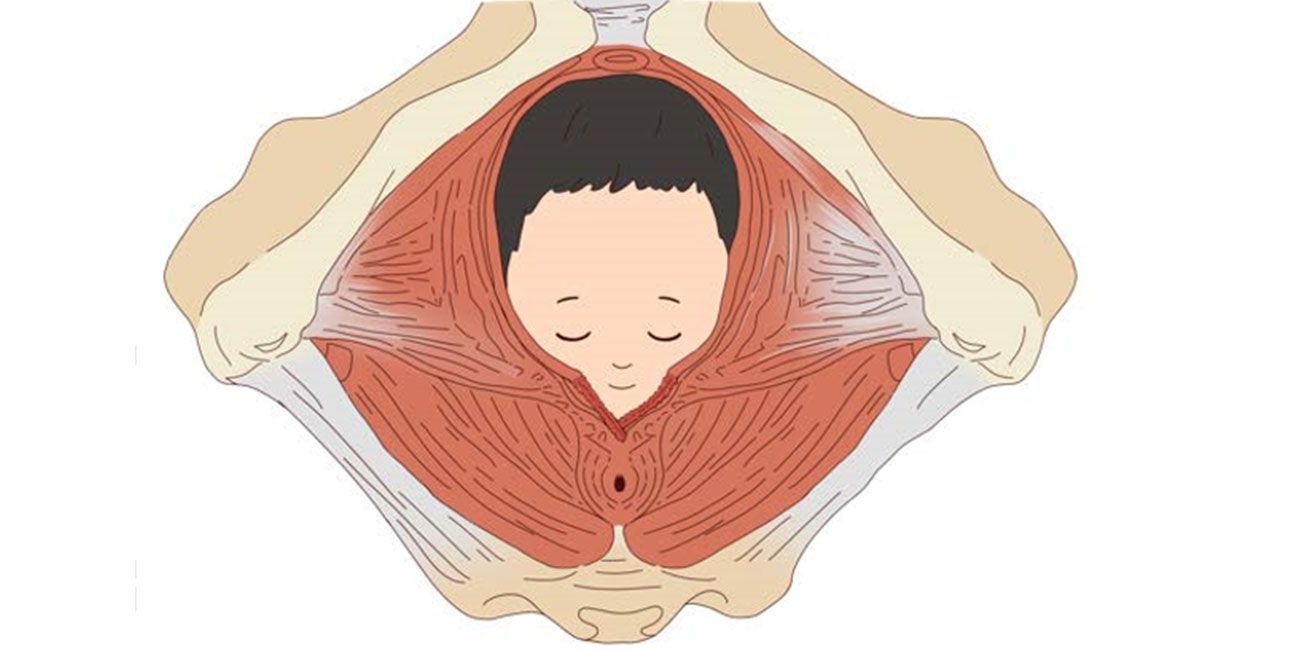 生完孩子为什么会出现子宫脱垂？主要是这6点造成的，务必小心