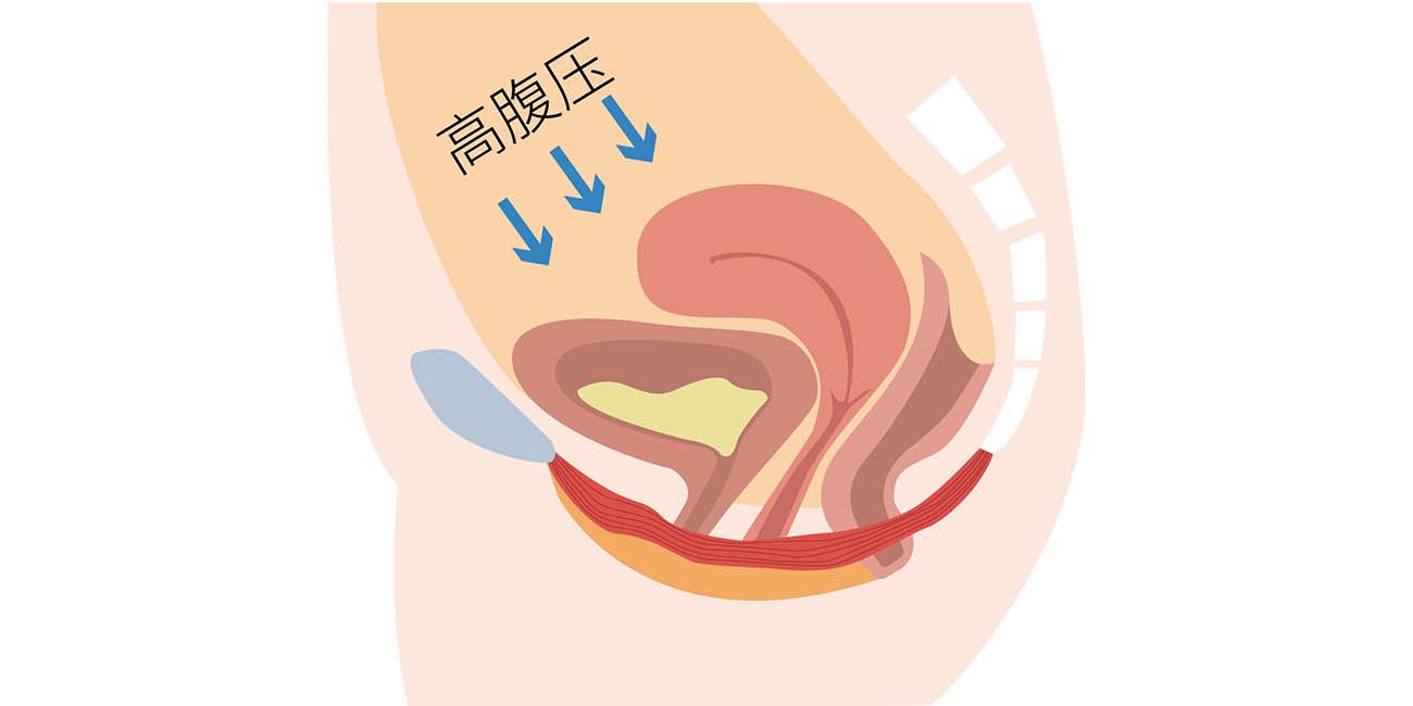 核心肌群特别是盆底肌，这4类女性需要着重锻炼