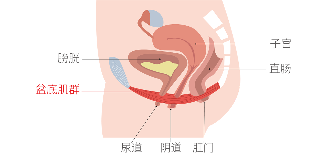 盆底肌松弛