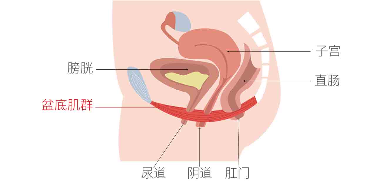 女性盆底肌功能障碍怎么治疗？这3种办法比较常用